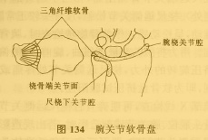 桡尺远侧关节(图134)损伤又称为下桡尺关节分离或腕三角纤维软骨