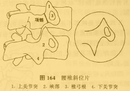 峡部不连及脊椎滑脱症